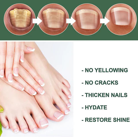 CrystalTips – Hydrating Serum for Stronger Nails