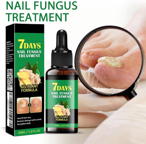 RootRenew – Ginger Nail Strengthening Oil