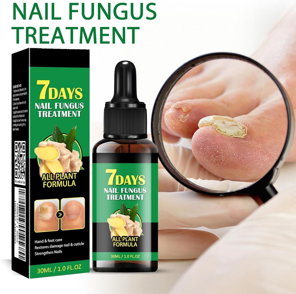 RootRenew – Ginger Nail Strengthening Oil