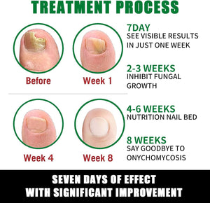RootRenew – Ginger Nail Strengthening Oil