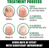 RootRenew – Ginger Nail Strengthening Oil