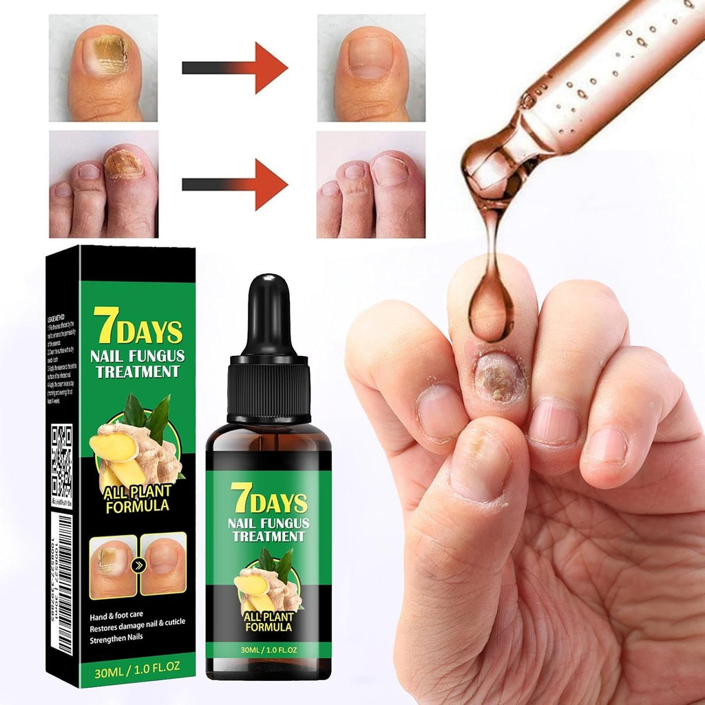 RootRenew – Ginger Nail Strengthening Oil