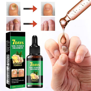 RootRenew – Ginger Nail Strengthening Oil