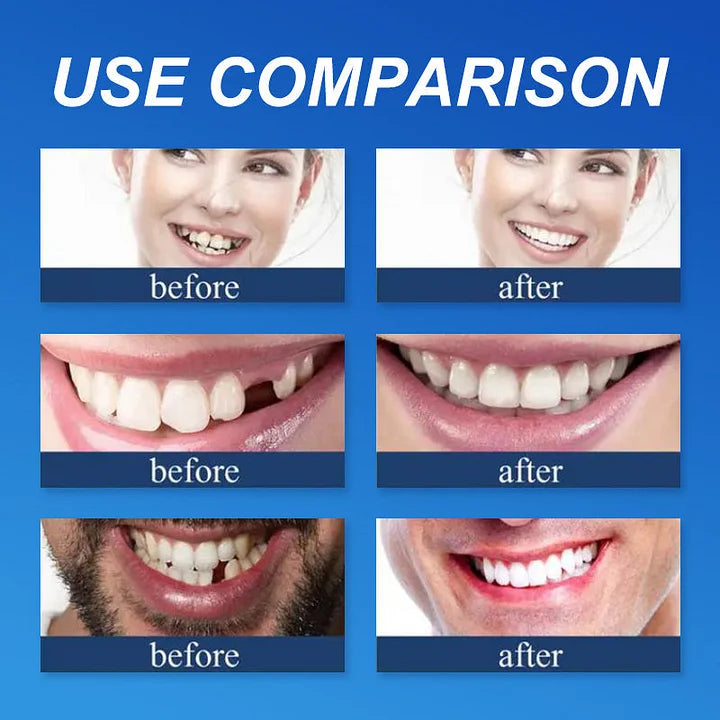 DentaGrip - Strong Suction Full Denture