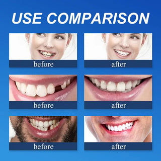DentaGrip - Strong Suction Full Denture