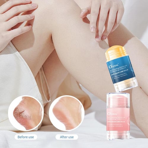 Bare Bliss Balm – All-in-One Skin Softener & Nourisher