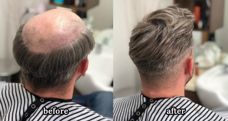 ThickLocks – Natural Hair Growth Booster Shampoo
