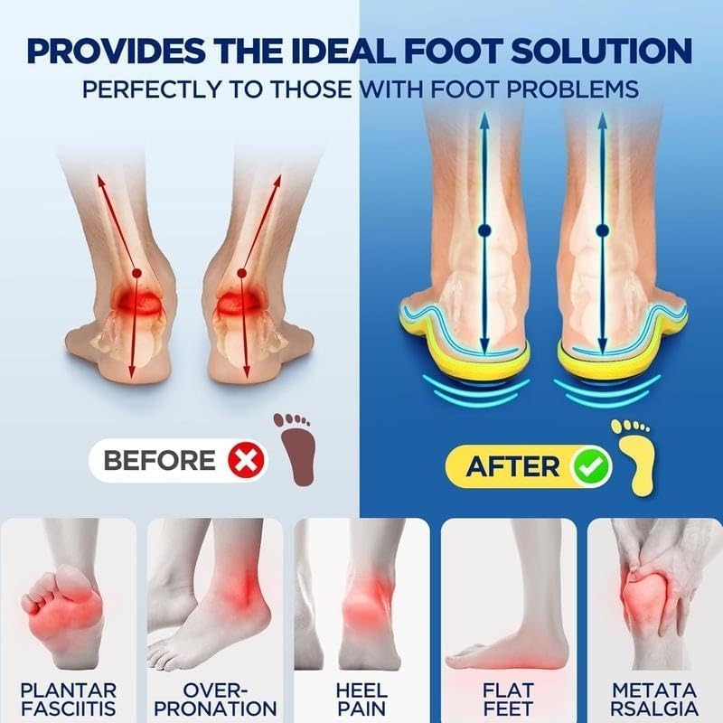 MagniStep – Magnetic Relief Insoles
