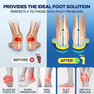 MagniStep – Magnetic Relief Insoles