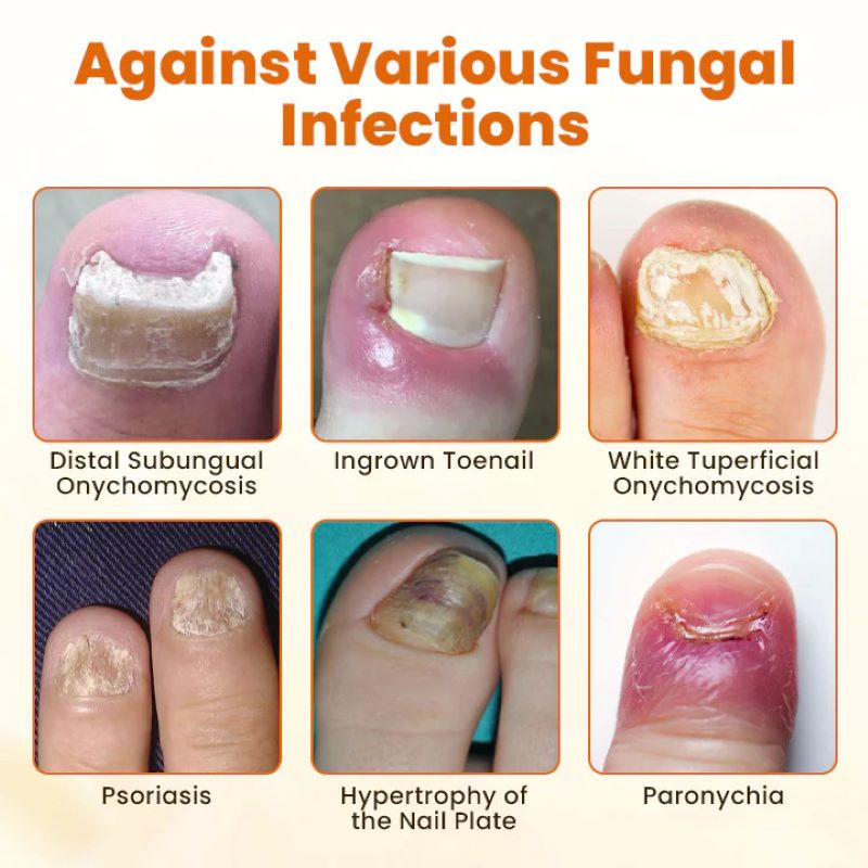 VenomNail – Bee Venom Repair Spray