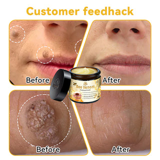 SkinShine - Advanced Bee Venom Skin Smoothing Cream
