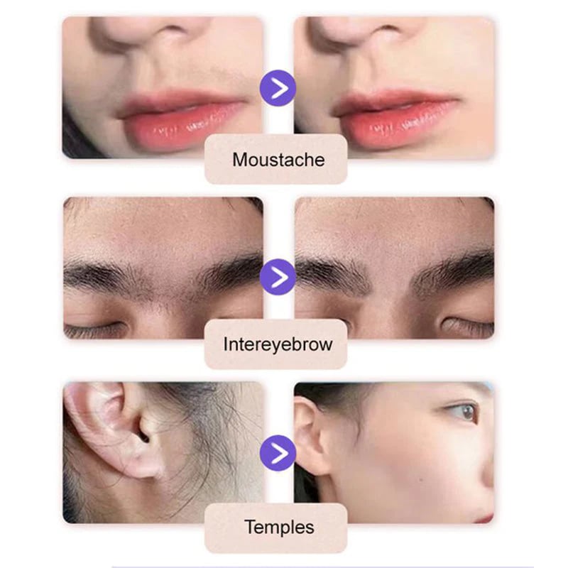 SoftSilk Pro - Painless Facial Hair Remover – Hydrating & Gentle