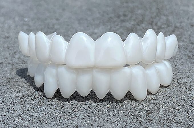 AuraSmile – Adjustable Clear Whitening Braces