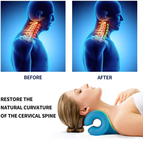 FlexNeck - Adjustable Cervical Traction Pillow