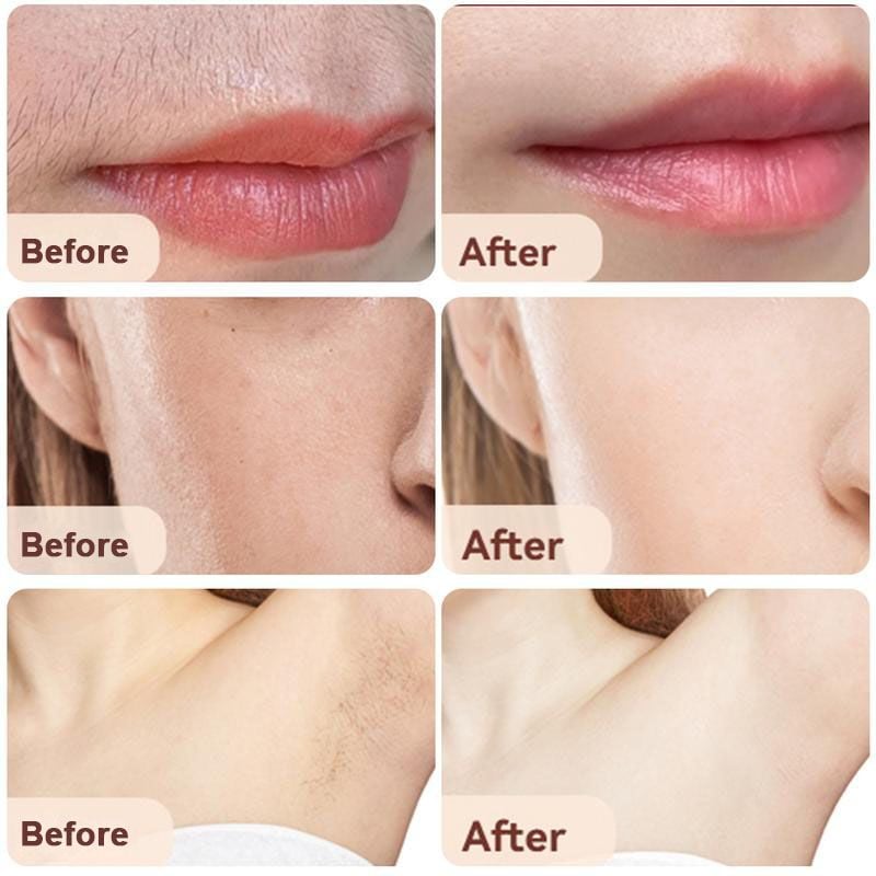 GlowTrim – 2-in-1 Facial Hair Remover