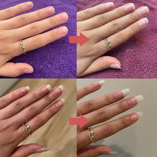 NailGlow - Nourishing pen for cuticles and dry nails