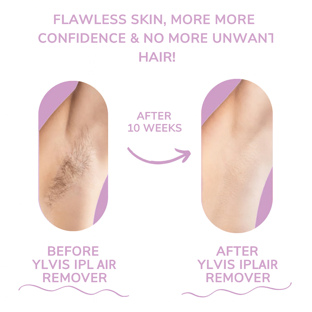 LumaGlow-IPL Hair Removal Device
