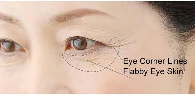 RedVita – Dragon’s Blood Easy Cream