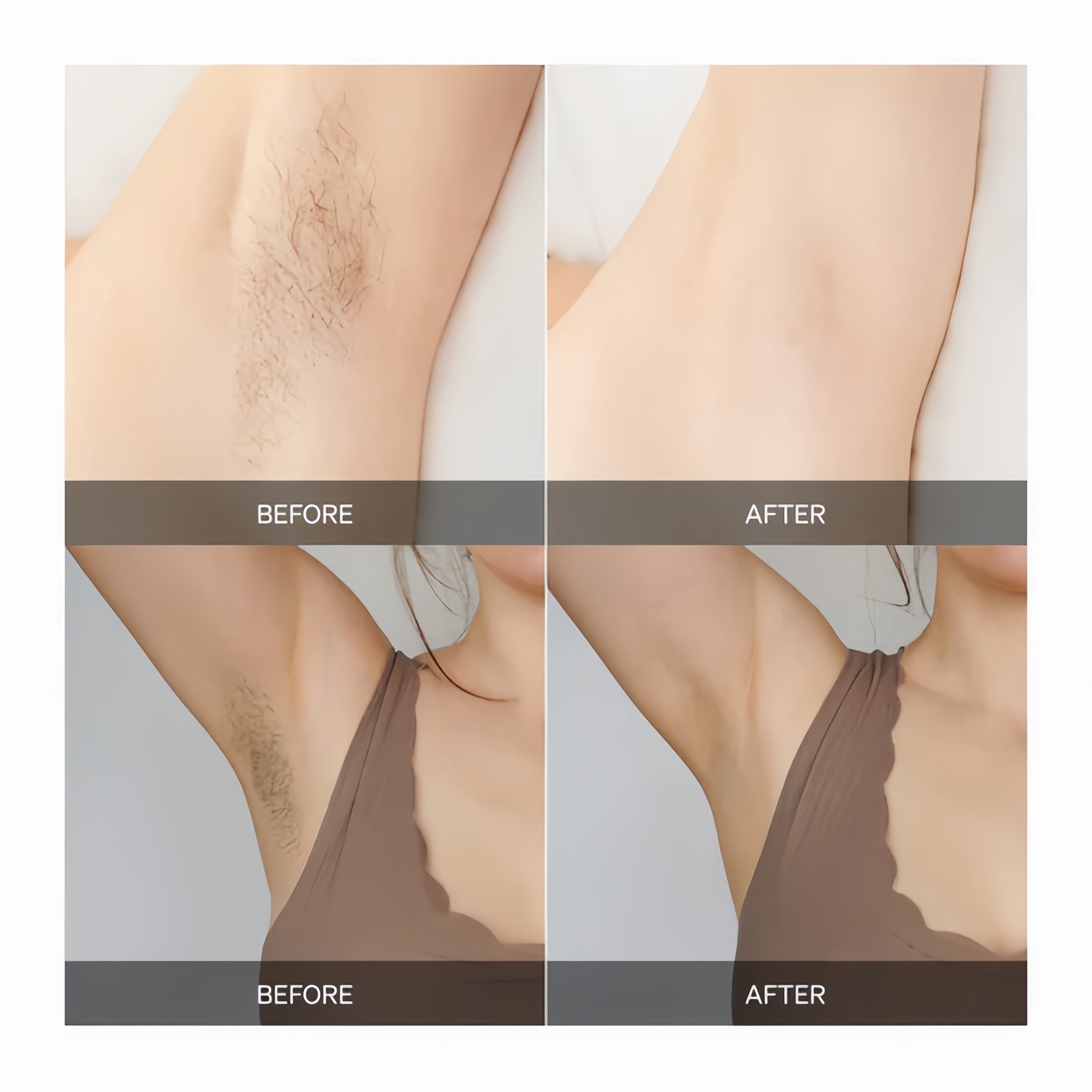 SmoothBeam – Full-Body Hair Removal Device