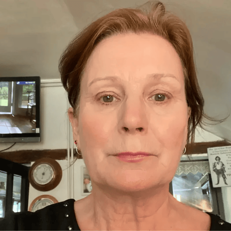 Vivaskin Hydrating Stick | Effortless Beauty Anytime