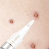 ClearGuard – Effective Wart Removal Pen