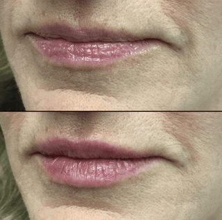 LumiLips – Long Lasting Moisture Lock Lipstick
