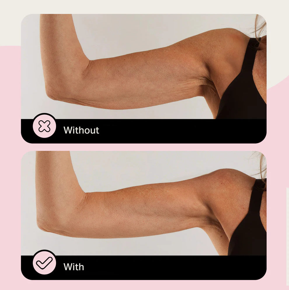 DermaBond – Skin Tape for Sensitive Skin