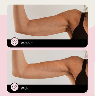DermaBond – Skin Tape for Sensitive Skin