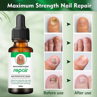 CrystalTips – Hydrating Serum for Stronger Nails