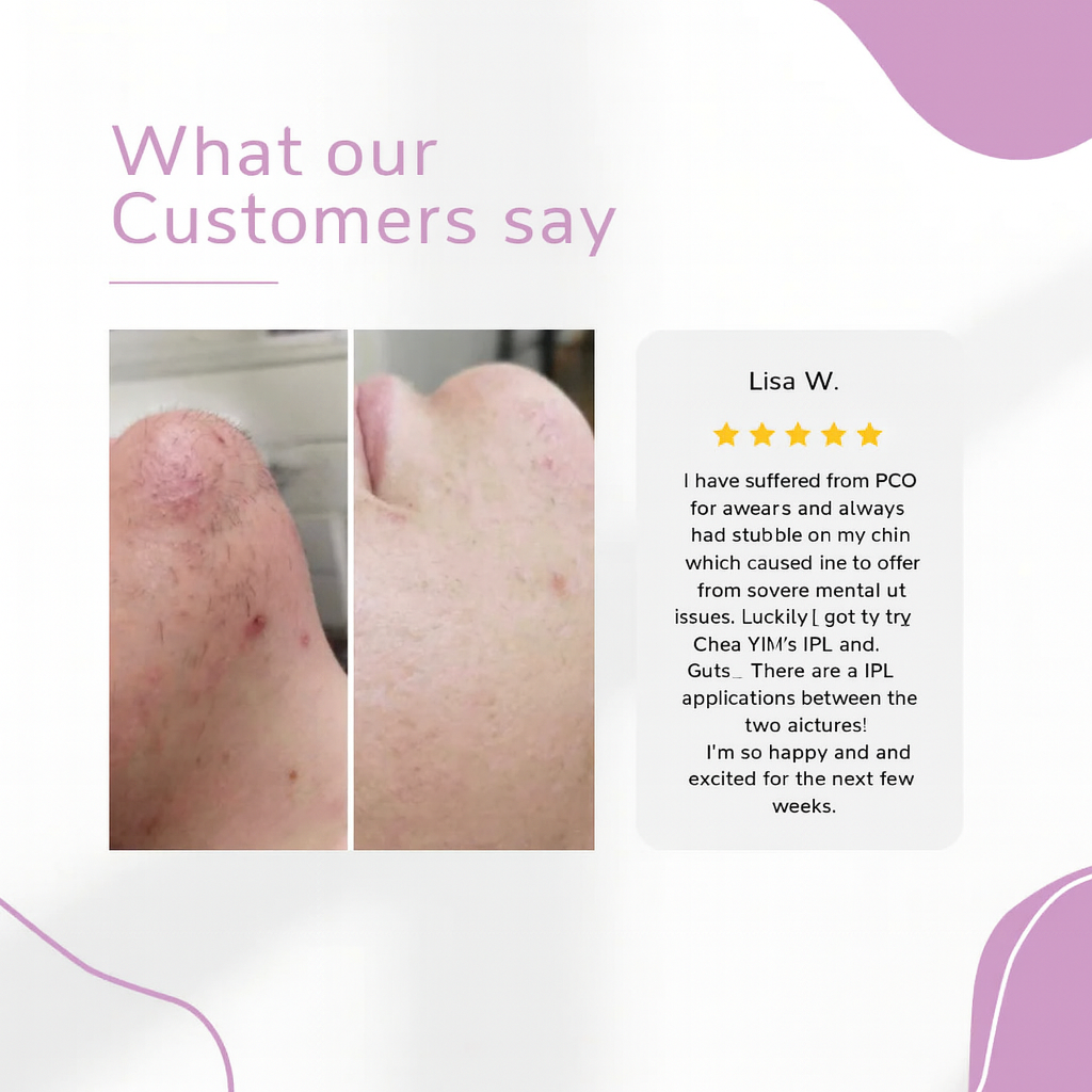 LumaGlow-IPL Hair Removal Device