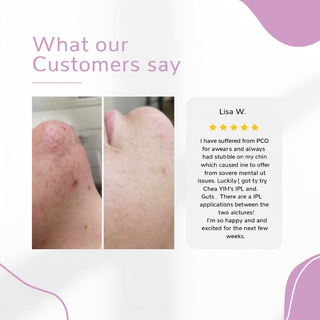 LumaGlow-IPL Hair Removal Device