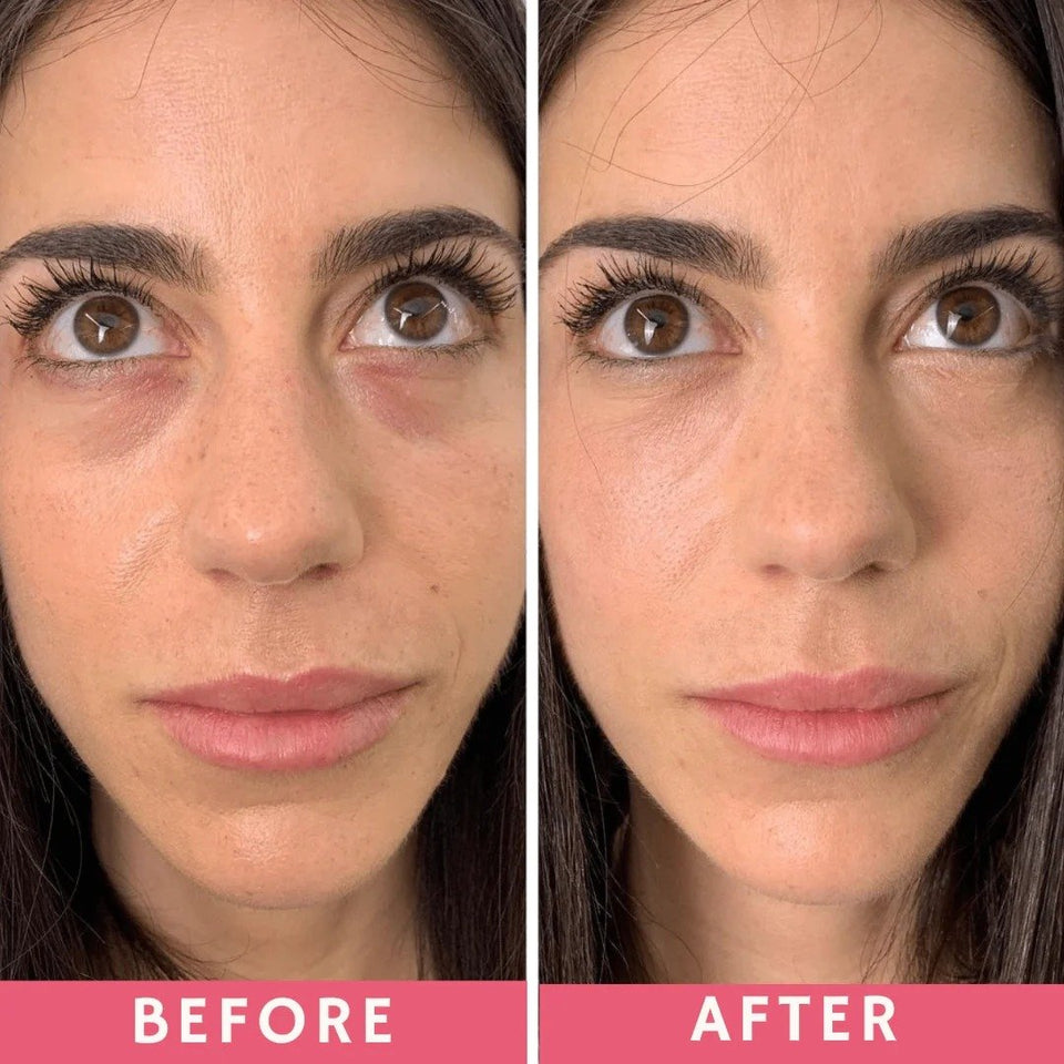 ⏳BUY 2 SAVE 10%! Under Eye Brightener