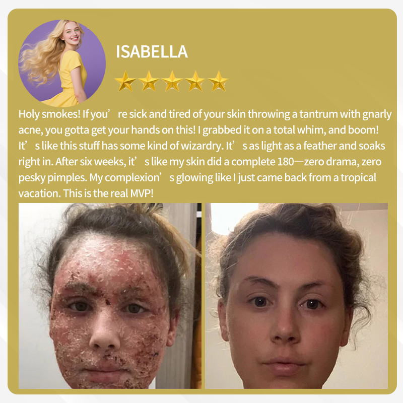 BeeVenom – Advanced Skin Restoration Cream