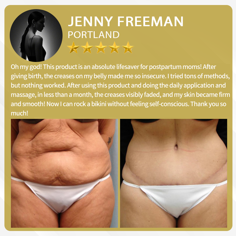 BeeVenom – Advanced Skin Restoration Cream