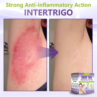 ClearDerma – Microneedle Skin Tag Removal Patch