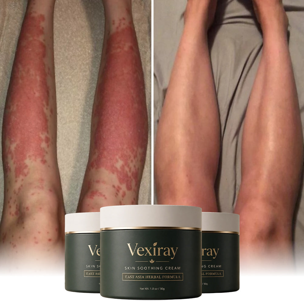 DermaRelief – Herbal Skin Recovery Cream