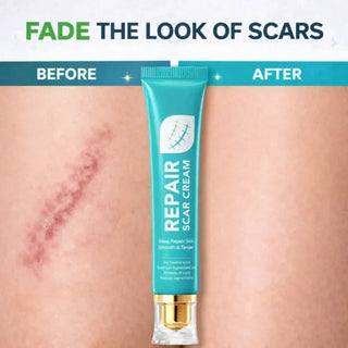 DermWise – Scar Repair & Skin Renewal Cream
