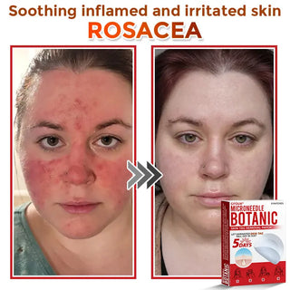 Natrvor –2-in-1  Microneedle Botanical Skin Renewal Patch
