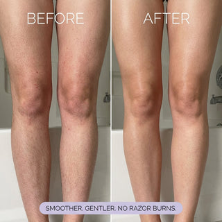 SilkPure – Instant Hair Removal Mousse