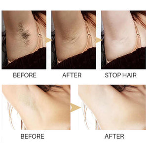 GlowBare – Smooth Skin Hair Removal Serum