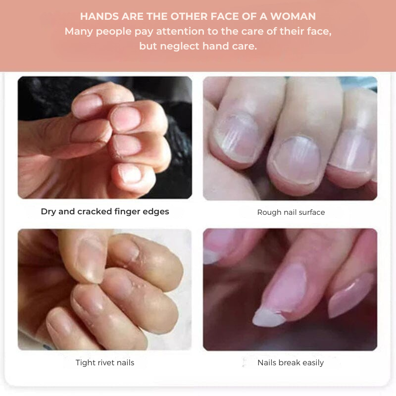 NailGlow - Nourishing pen for cuticles and dry nails
