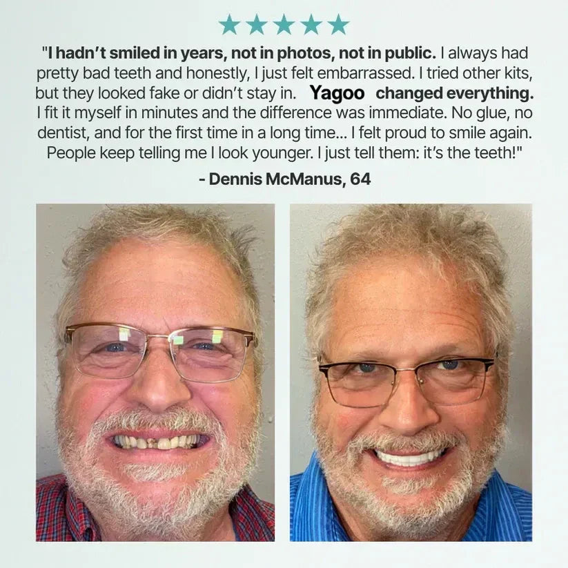DentaGrip - Strong Suction Full Denture