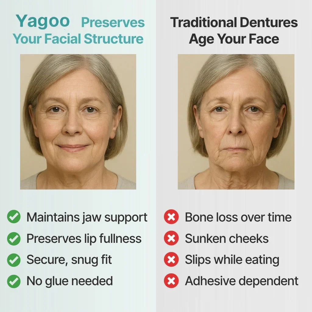 DentaGrip - Strong Suction Full Denture