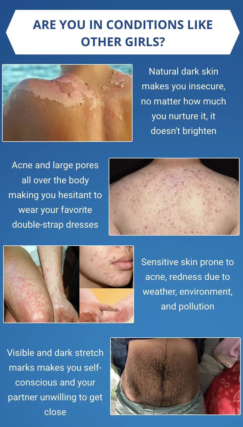 HallyGlow – Niacinamide Brightening Body Lotion