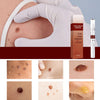 ClearGuard – Effective Wart Removal Pen