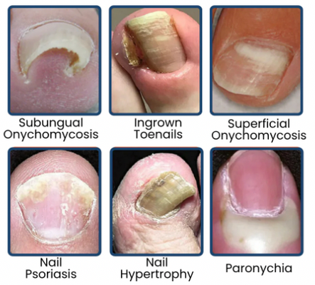 NailRevive – Deep Care Patches