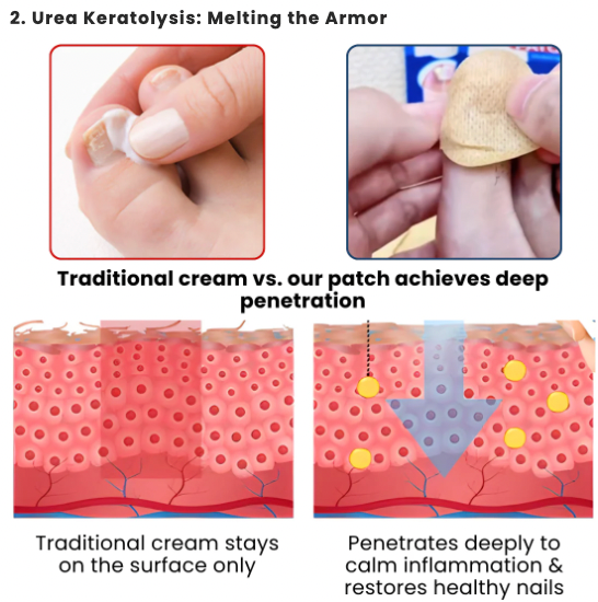NailRevive – Deep Care Patches