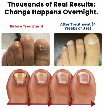 NailRevive – Deep Care Patches