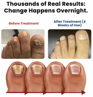 NailRevive – Deep Care Patches