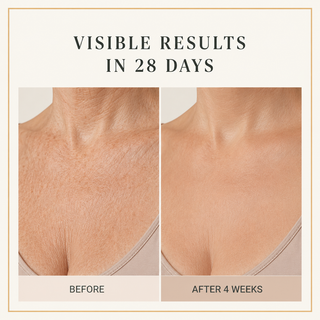 The most popular non-sensitive, exquisite skin moisturizer recently